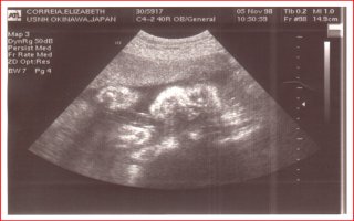 ultrasound pic