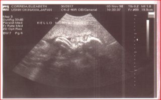 ultrasound pic