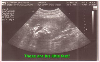 ultrasound pic