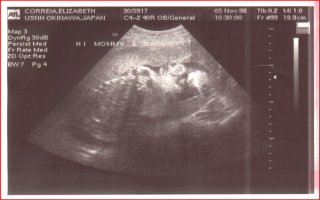 ultrasound pic